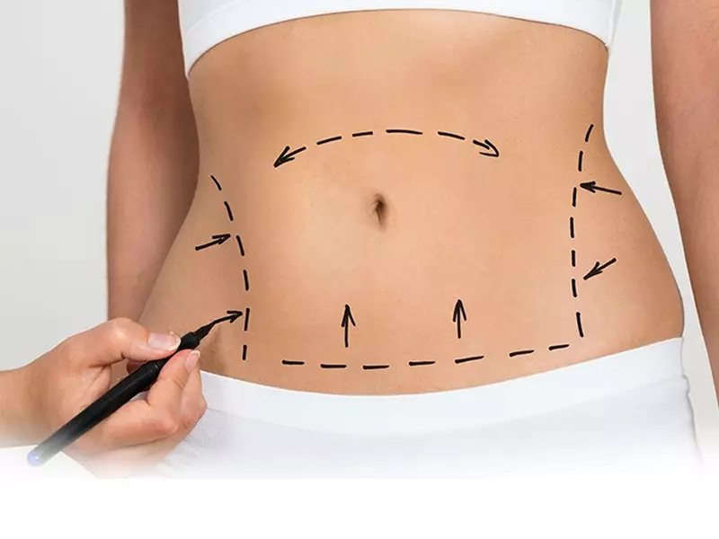 regional-slimming