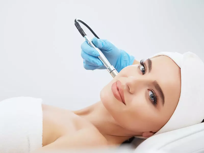laser-acne-treatment