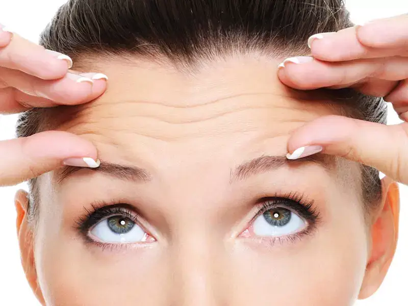 what-causes-forehead-wrinkles