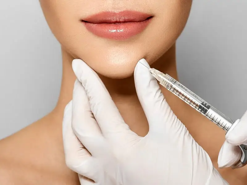 jawline-filling-in-bilecik