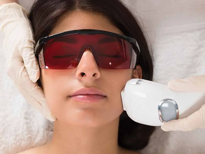 fractional-laser-in-bilecik