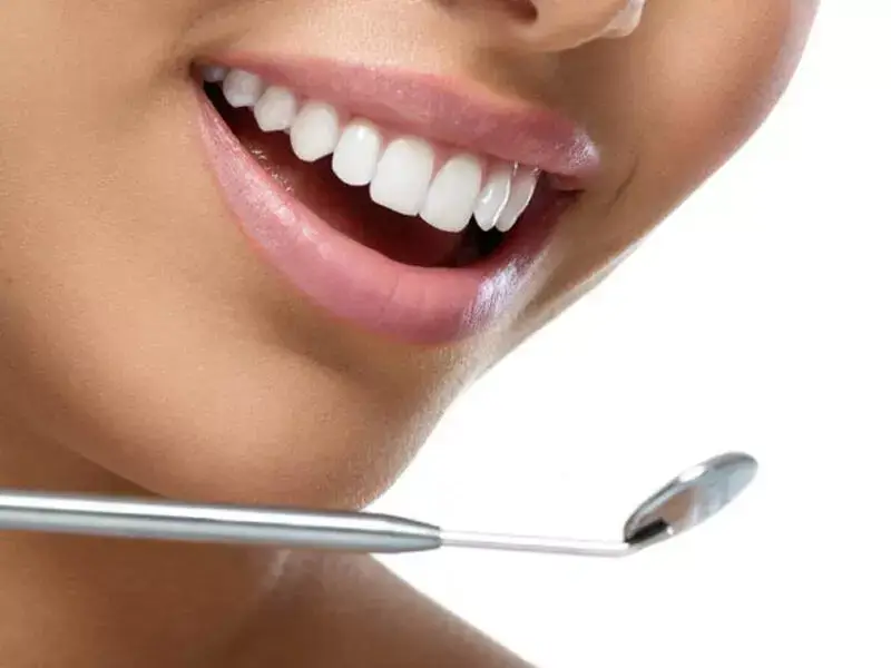 gummy-smile-filler-in-bilecik