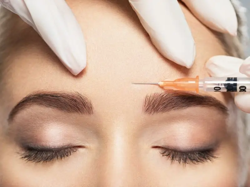bursa-forehead-filling