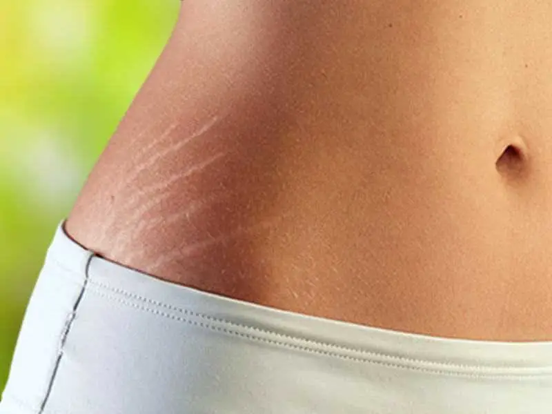 Cracks and Scars
