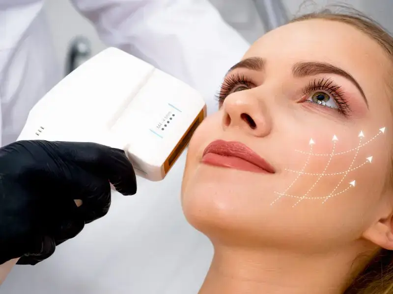non-surgical-face-lift-in-eskisehir