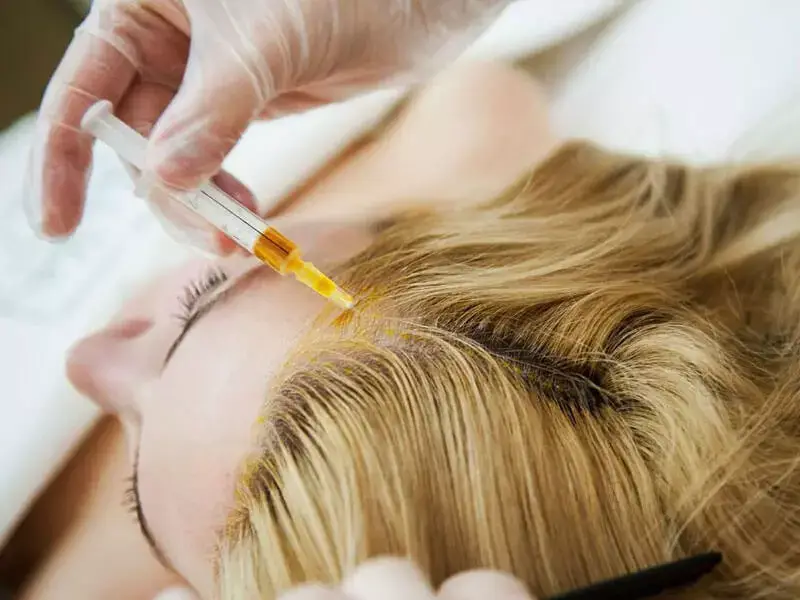 eskisehir-hair-loss-mesotherapy