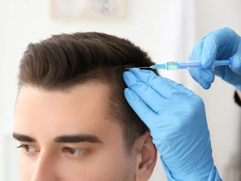 eskisehir-hair-mesotherapy