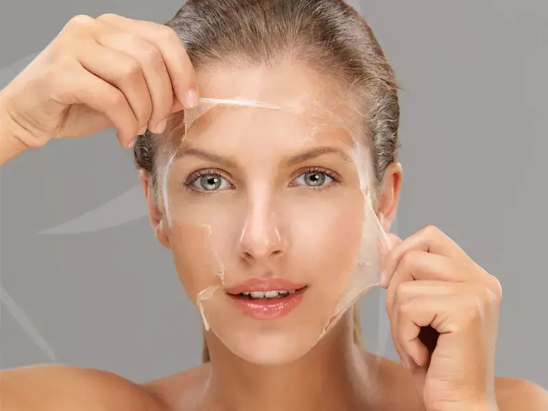 kimyasal-peeling-sonrasi-kizariklik-ne-kadar-surer