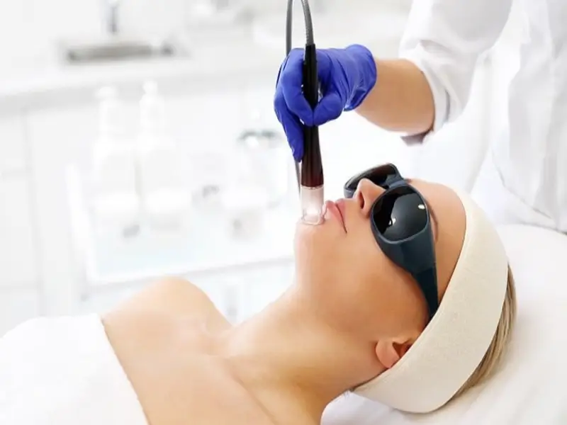laser-spot-treatment-prices