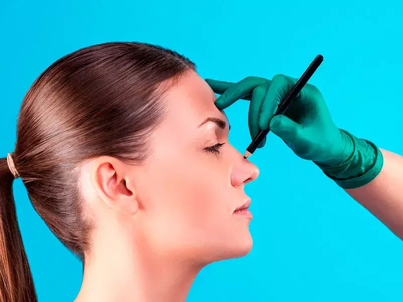 nasal-bridge-correction
