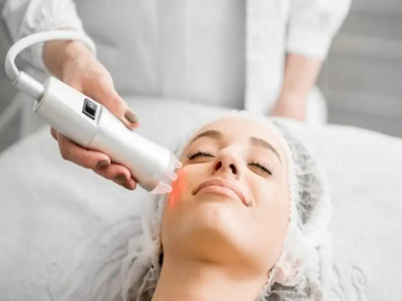 those-who-had-bbl-laser-treatment