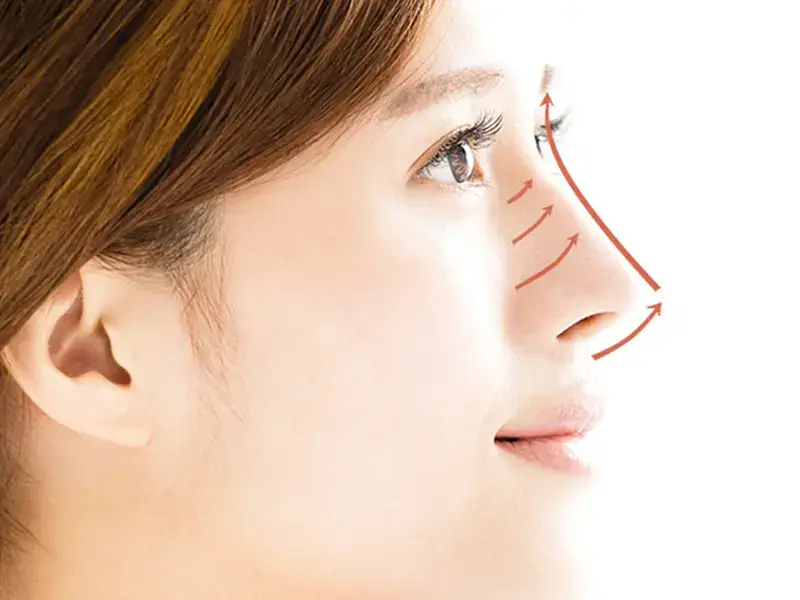 upturned-nose