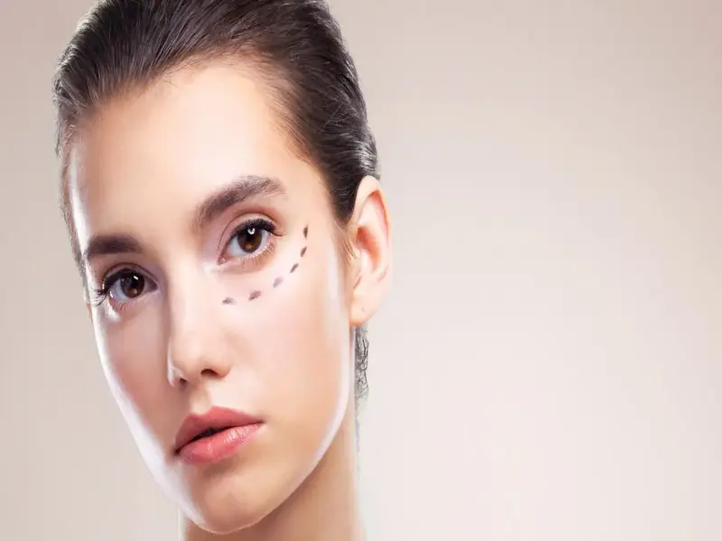 how-do-facial-depressions-go-away