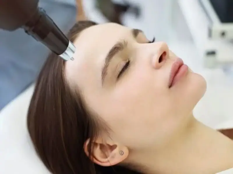 laser-prices-for-facial-spots